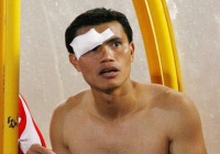 Tài Em phải khâu 6 mũi sau trận hòa 1-1 SLNA Tài Em phải khâu 6 mũi sau trận hòa 1-1 SLNA