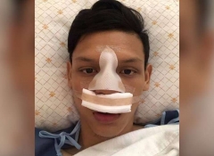 Buiram forward Supachai broke his nose in a violent phase against Chiangmai
