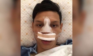 Buiram forward Supachai broke his nose in a violent phase against Chiangmai Buiram forward Supachai broke his nose in a violent phase against Chiangmai