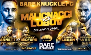 TRỰC TIẾP Boxing: Artem Lobov vs. Paulie Malignaggi TRỰC TIẾP Boxing: Artem Lobov vs. Paulie Malignaggi