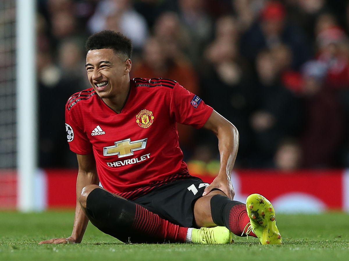 Lingard bị chấn thương gân kheo Solskjaer, Martial, Lingard, chấn thương MU, Martial chấn thương, MU, tin Man United, tin bong da, FA Cup