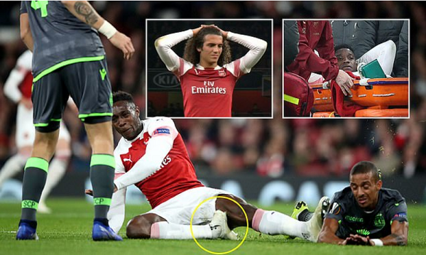 Tình huống chấn thương của Welbeck