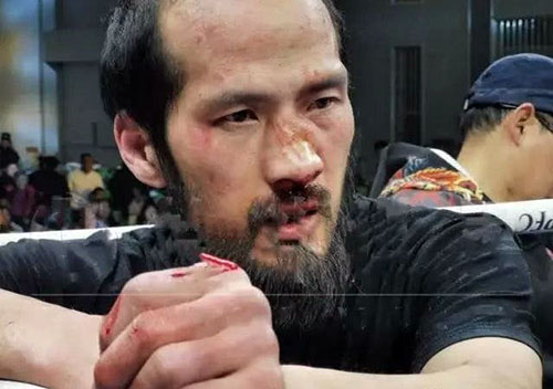 Lã Cương bê bết máu sau những đòn đánh của Từ Hiểu Đông Từ Hiểu Đông, Lã Cương, Từ Hiểu Đông đối đầu Lã Cương