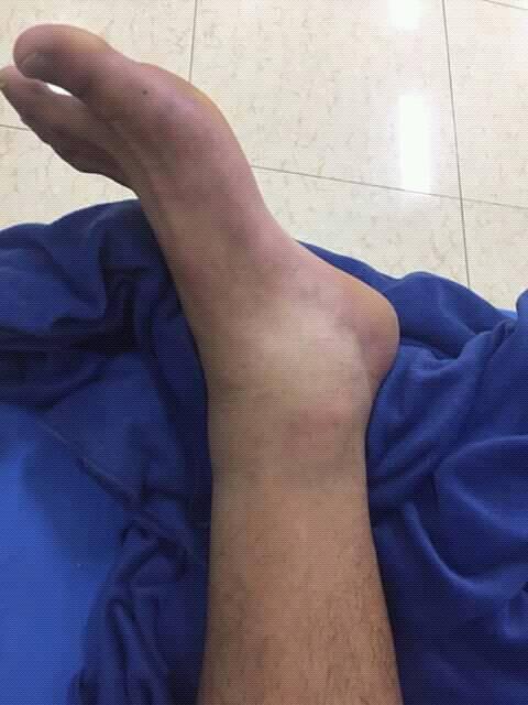 Dương Văn Hào, Văn Hào gãy chân, CLB Long An, CLB Viettel, Phan Văn Giàu, HLV Đặng Phương Nam