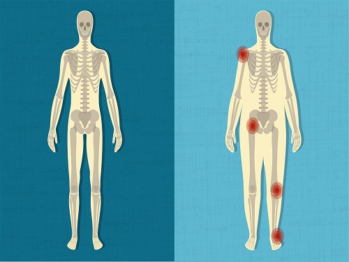 Thừa cân gây ảnh hưởng đến sức khỏe cách giảm cân