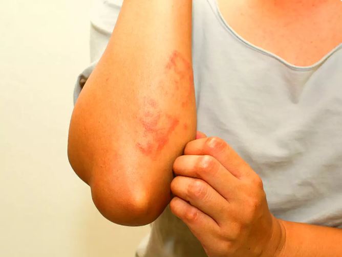 Mần ngứa man ngua khi boi