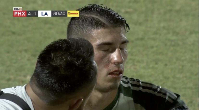 Thủ thành của LA Galaxy 2 bị ném lon bia trúng mặt - Ảnh: Reddid pháo sáng, hooligan, cđv ném pháo sáng, cđv tấn công cầu thủ, cđv ném bia, cđv ném vật thể lạ