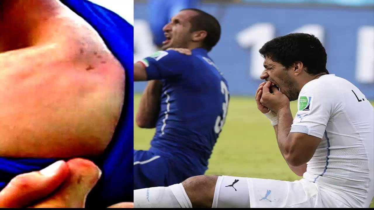 Suarez cắn vào vai Chiellini tại World Cup 2014. Ảnh: Youtube Chiellini, Suarez, Italia, Ý, Uruguay, World Cup, World Cup 2014